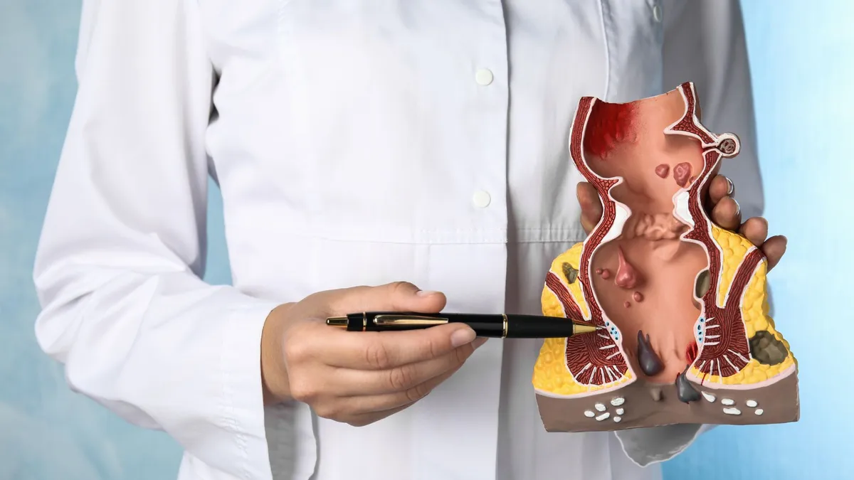 Giải phẫu hậu môn và những điều cần biết về bệnh lý hậu môn