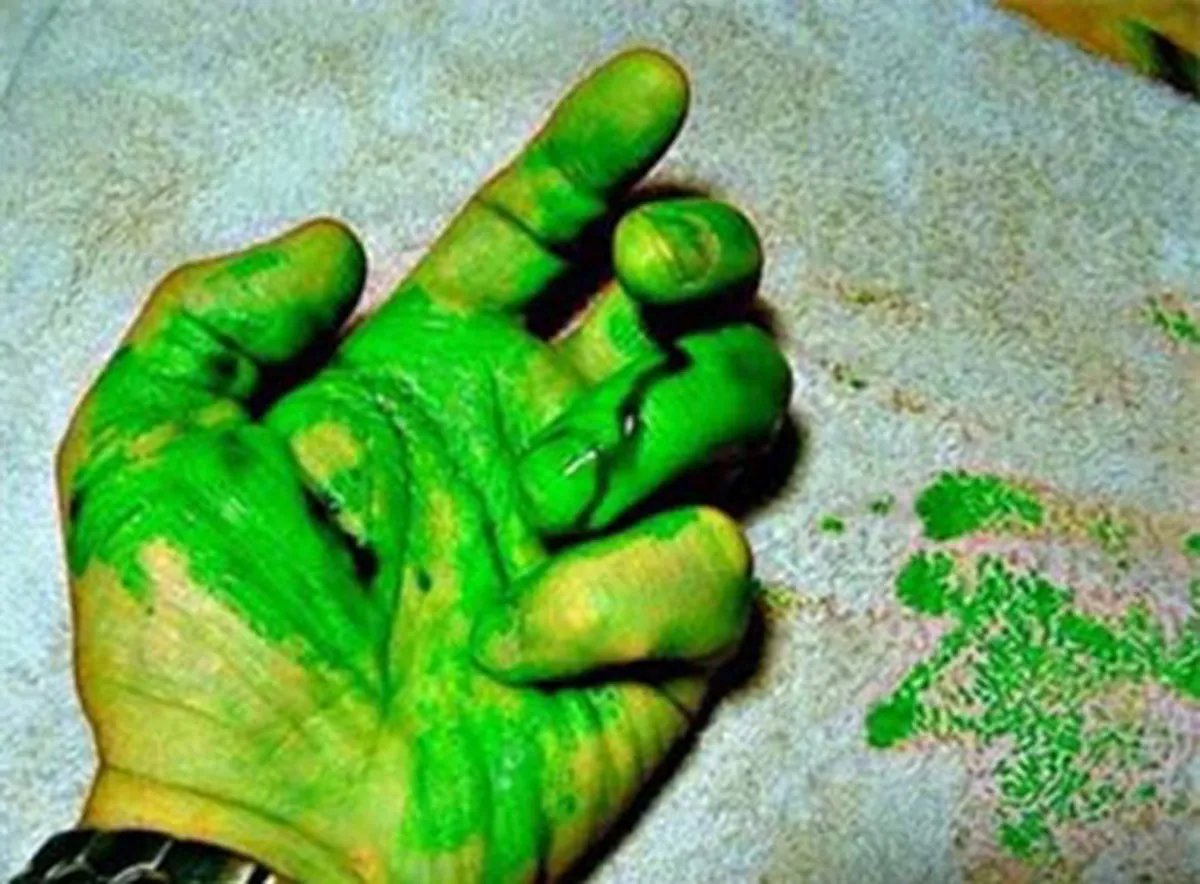 Thú vị hiện tượng máu màu xanh lá cây