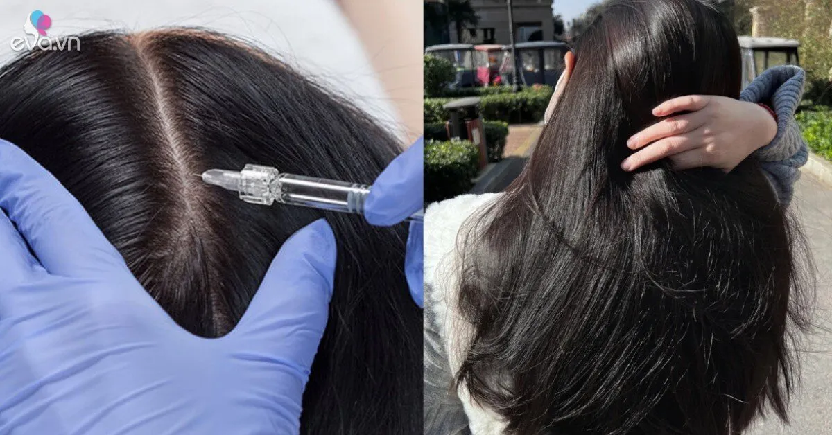 Không cần nhuộm, phái đẹp rỉ tai nhau phương pháp tiêm filter tóc làm dày và chống bạc, liệu có thật?