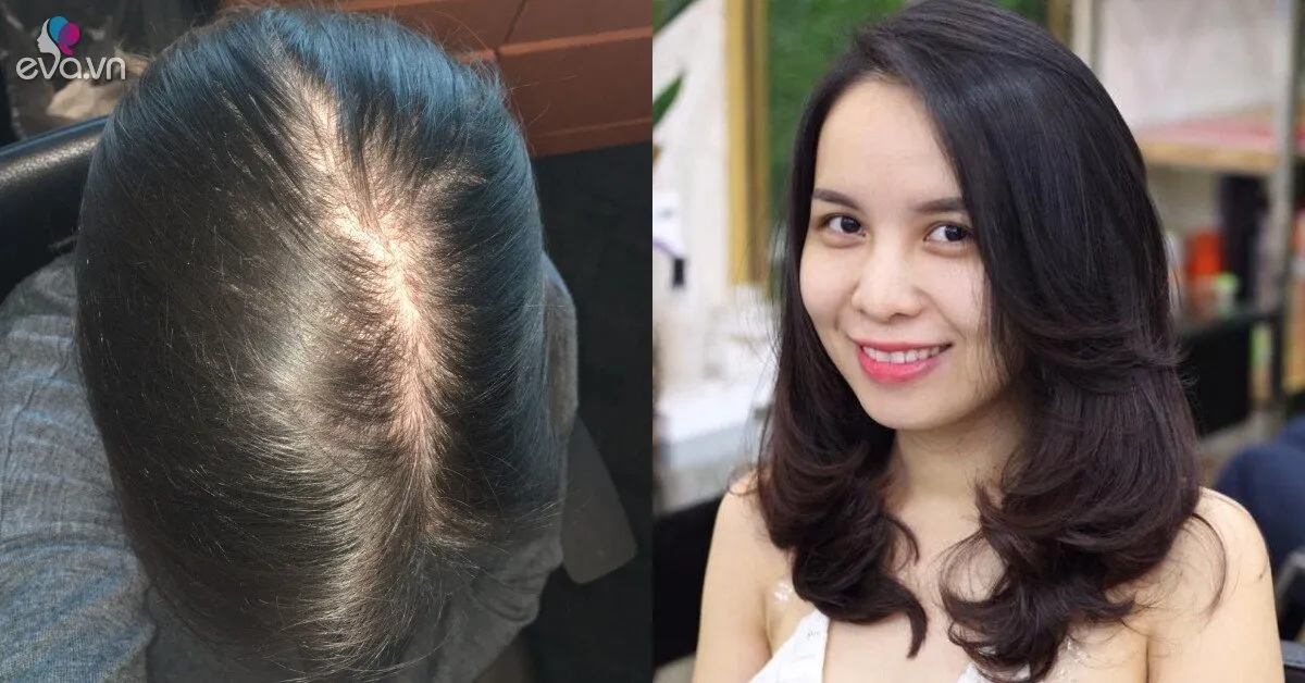 Không cần thuốc đắt tiền, phụ nữ U40 vẫn có thể sở hữu mái tóc dày khỏe nhờ 5 thay đổi trong sinh hoạt