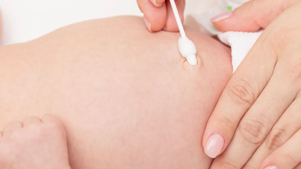 Cách vệ sinh rốn khi bị nhiễm trùng đúng tại nhà