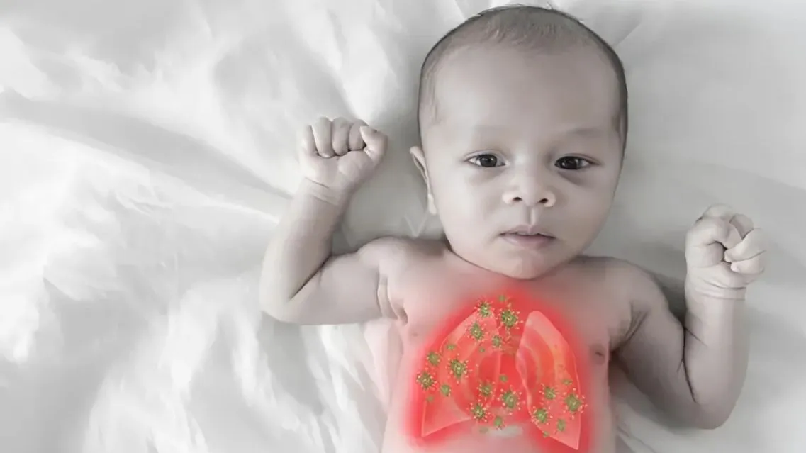 Viêm phổi ở trẻ sơ sinh: Nguyên nhân, triệu chứng và cách điều trị