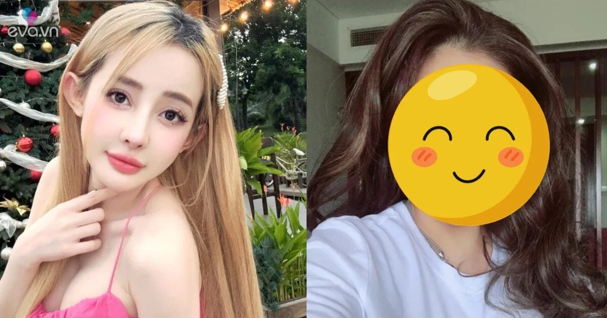 Ngân 98 công khai phẫu thuật thẩm mỹ 10 lần, vẫn chưa là gì so với "vợ Trấn Thành"