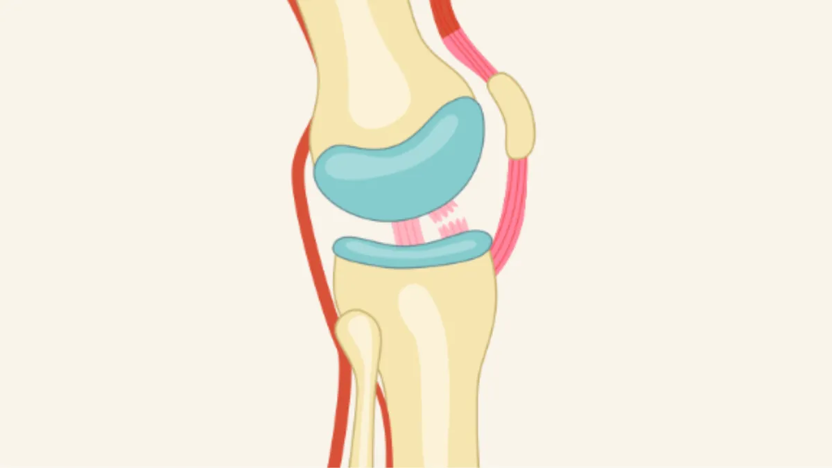 Đứt dây chằng chéo trước là gì? Nguyên nhân và dấu hiệu cảnh báo
