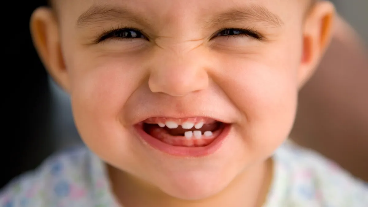 Lịch thay răng sữa ở trẻ và những điều ba mẹ nên biết