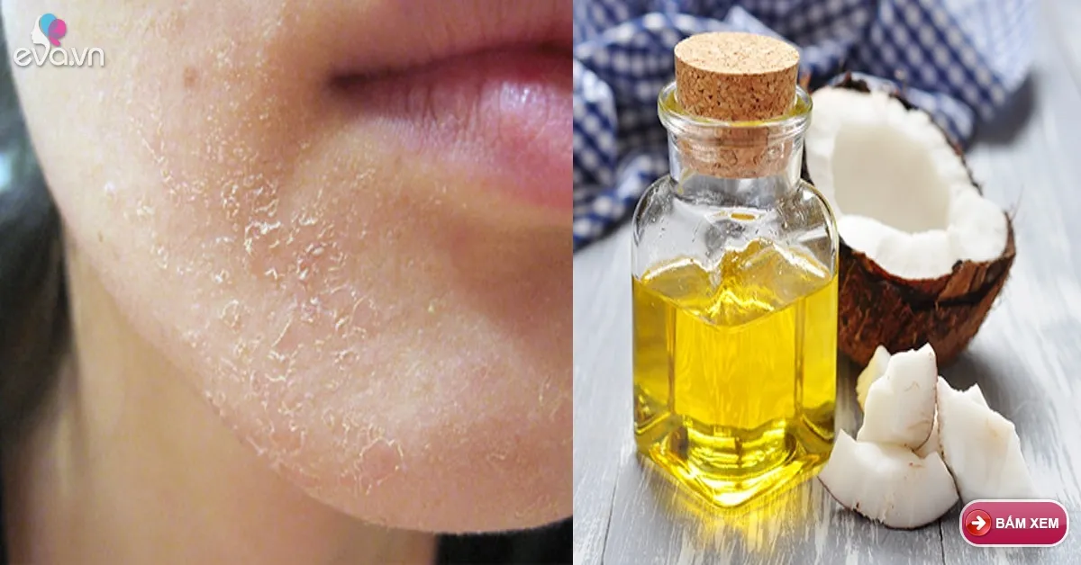 Giải pháp nào giúp ích làn da khô nẻ trong mùa lạnh
