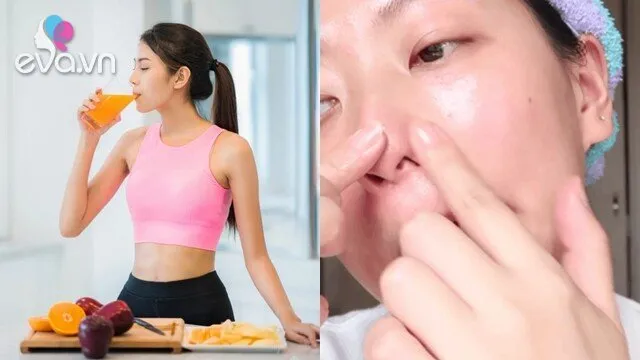 Muốn trị dứt điểm mụn đầu đen? Tránh xa 3 thực phẩm này nếu không muốn công sức skincare đổ sông đổ biển