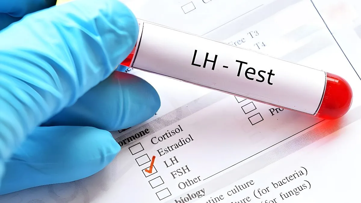 Xét nghiệm LH là gì? Xét nghiệm LH có chỉ số bao nhiêu là bình thường?