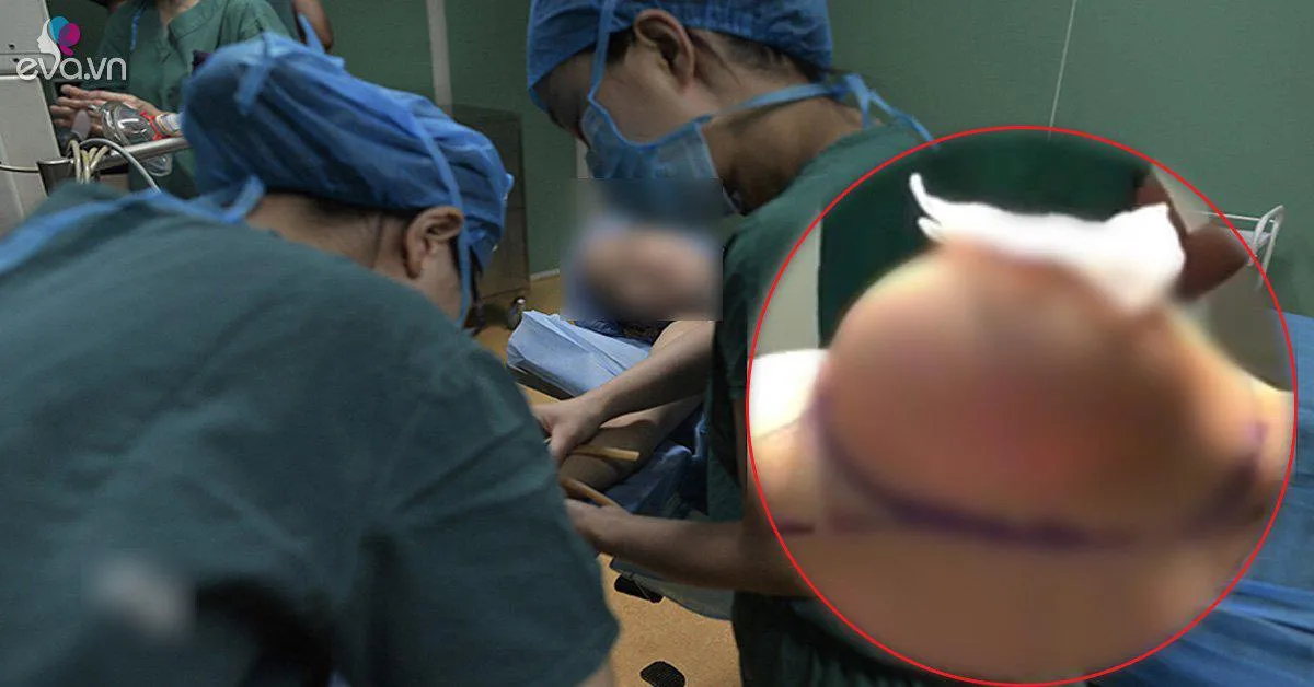 Nâng ngực lên 700cc, cô nàng này chính thức sở hữu vòng 1 "khủng" nhất Việt Nam!